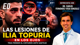 Prestigioso oftalmólogo analiza la preocupante lesión ocular de Topuria: "A veces se quedan atrapados los músculos que mueven el ojo"