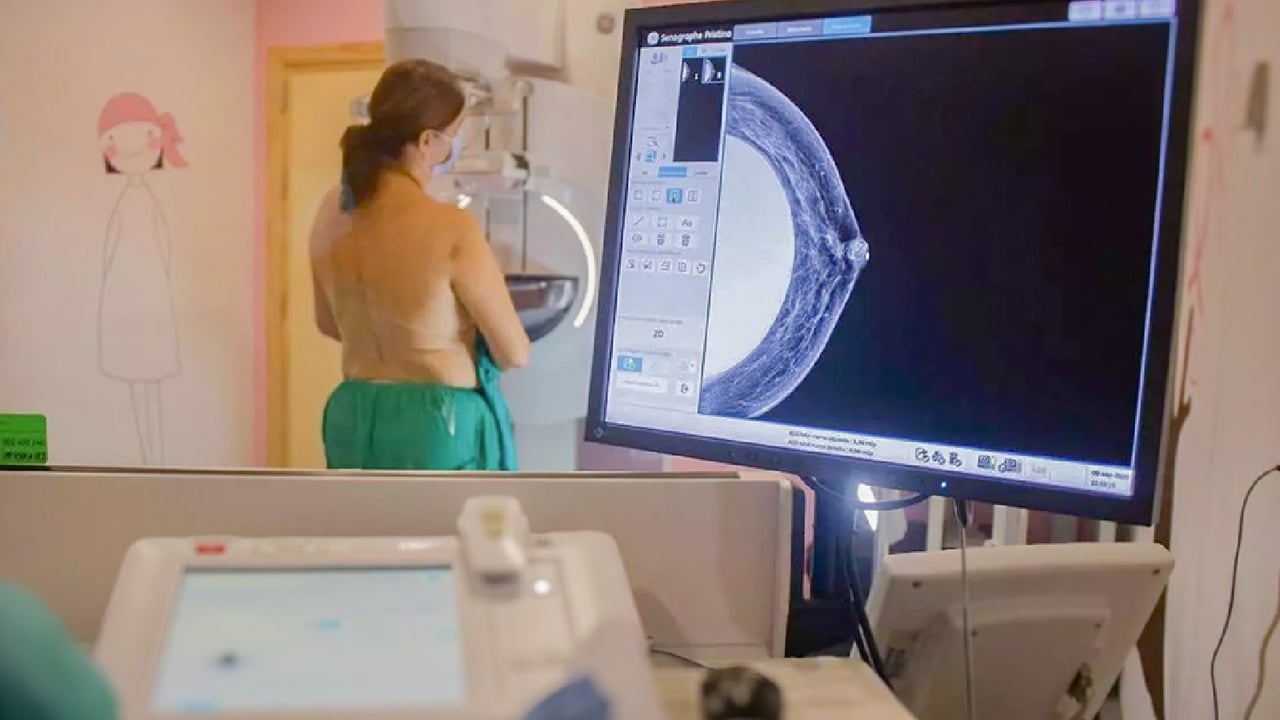 Salud contactará con 2.000 mujeres para corregir los errores del cribado del cáncer de mama
