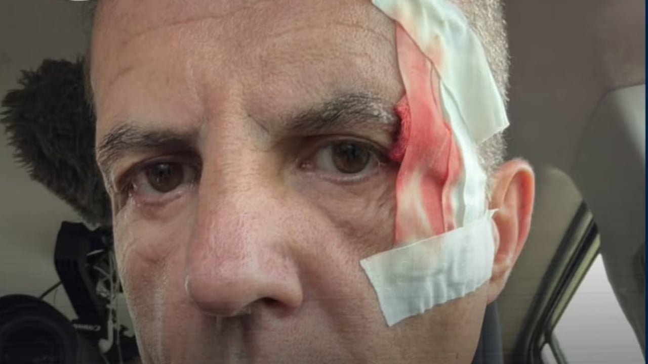 Cristóbal Soria, última hora sobre su estado de salud tras el accidente en Costa Rica: "Me llevo cinco puntadas"