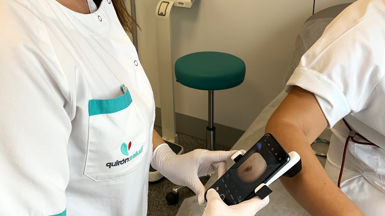 La detección precoz y la protección solar son los mejores escudos para salvar vidas frente al cáncer de piel