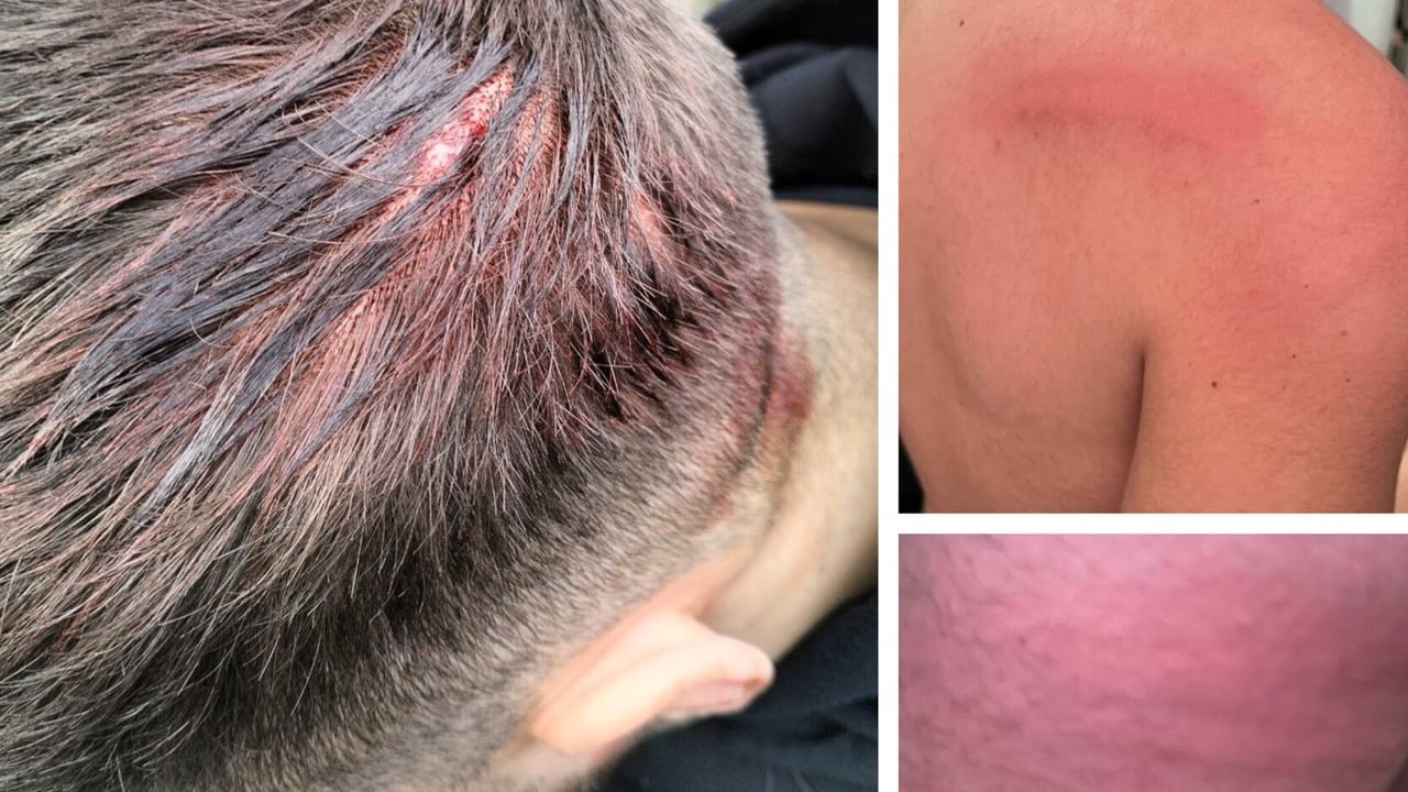 Clamor contra la Policía durante la visita del Betis al Almería